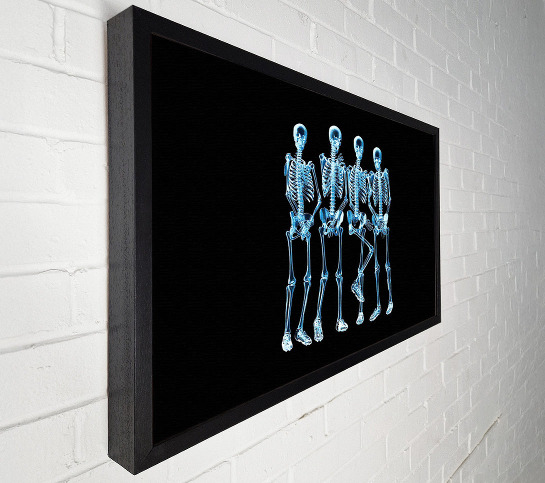  A Canvas Print of Funny Bones Canvas Art