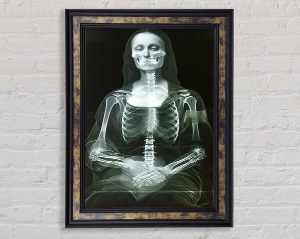 Xray Woman Framed Print