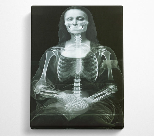  A Canvas Print of Xray Woman Canvas Wall Art